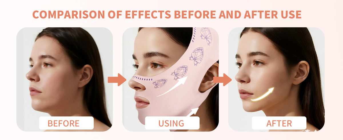 ContourLift™ Jawline & Chin Sculpting Mask